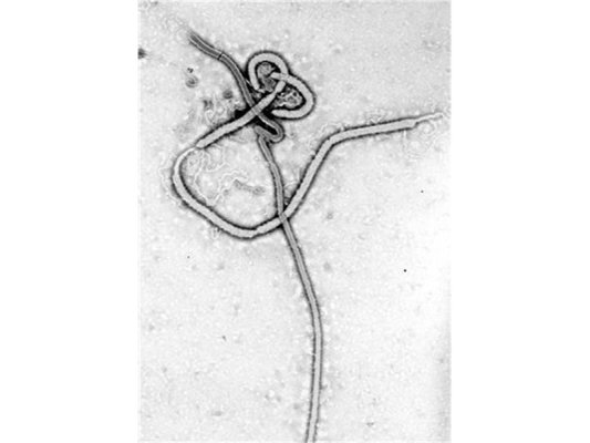 Fransa'da İlk Ebola Vakası Görüldü