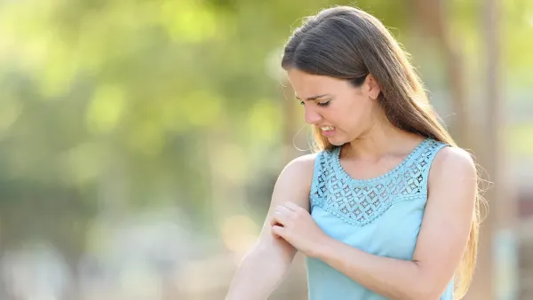 Sivrisinekler Neden Bazı İnsanları Daha Çok Sever?